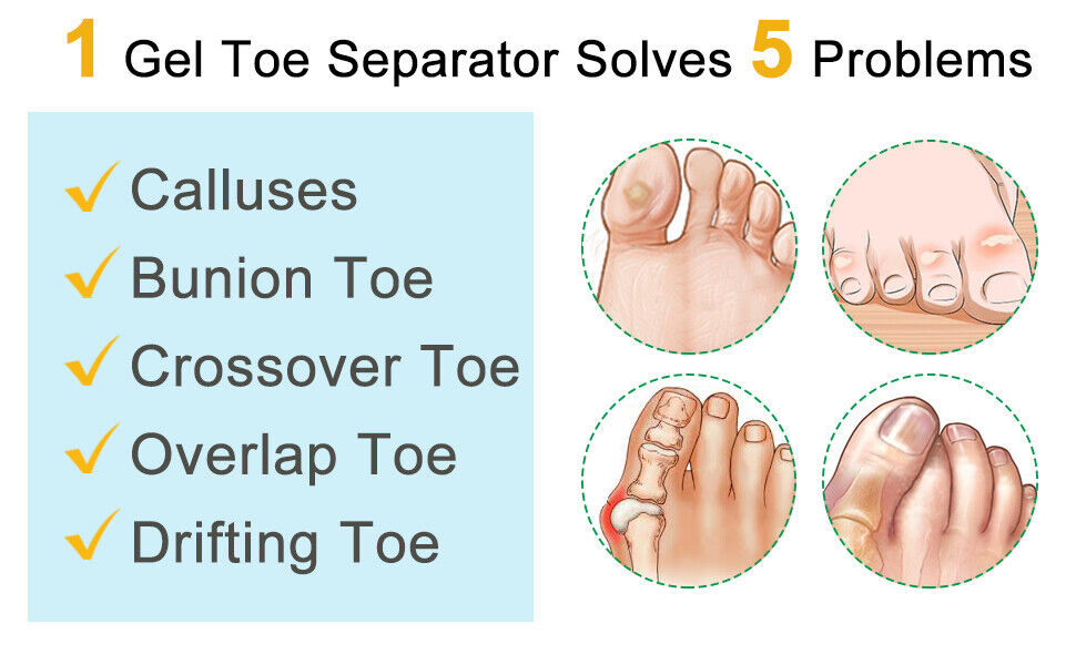 Double Loops Big Toe Straightener Separators Bunion Pads for Crooked Hammer Toes