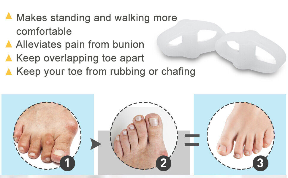 Double Loops Big Toe Straightener Separators Bunion Pads for Crooked Hammer Toes